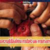 สาระความรู้เรื่องไก่ชน การไขหัว และ การถ่างตาไก่ 